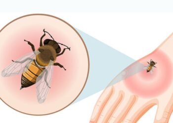 Hello Telugu - Bee Bite Proven Remedy