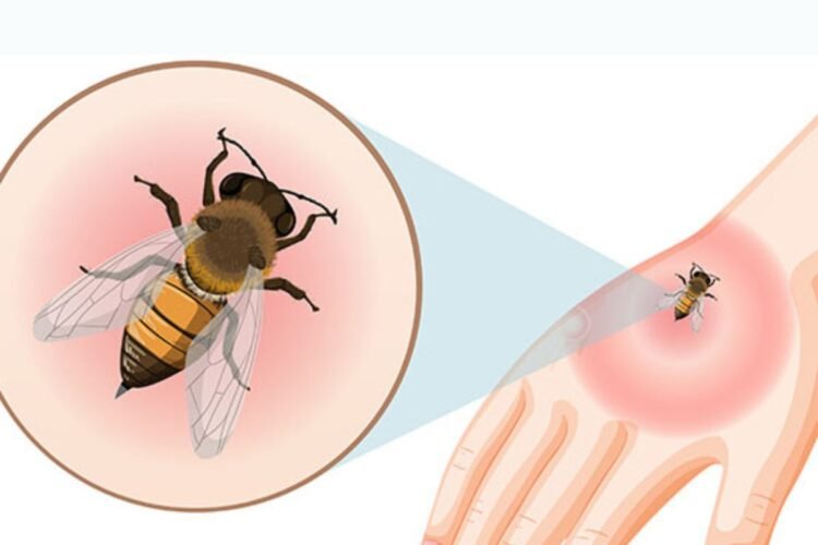 Hello Telugu - Bee Bite Proven Remedy