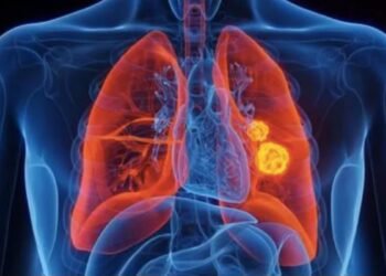 Hello Telugu - Rising Lung Cancer Sensational